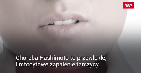 Nietypowe objawy Hashimoto