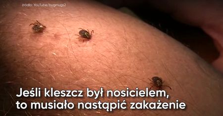 Borelioza. Fakty i mity