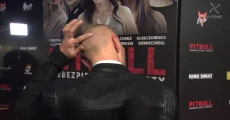 Gojdź o przeszczepie włosów: "Chciałem zwrócić uwagę na problem raka jajnika"