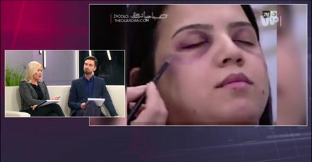 Makijaż, dzięki któremu zatuszujesz siniaki po pobiciu przez męża. Kobiety są oburzone