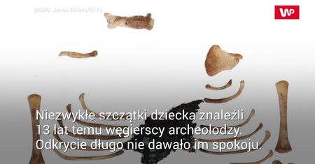 Zagadka zmumifikowanej rączki. Pierwszy taki przypadek w historii