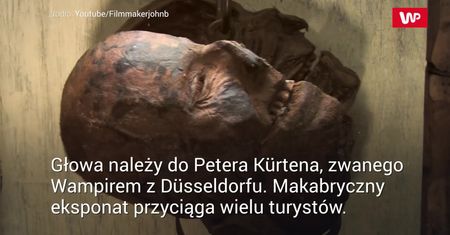 Przebadali mózg zbrodniarza, by szukać przyczyny straszliwych czynów. Wyniki zaskakują