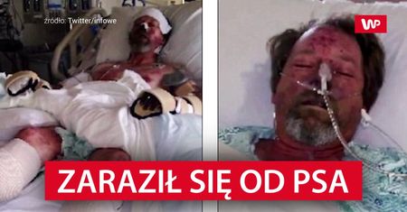 Zaraził się od psa