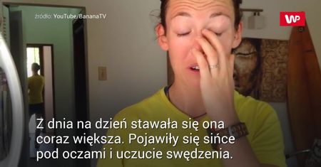 Jadła więcej soli. Zobacz co się stało