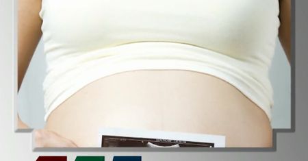 Najdłuższy poród w historii [Pixel]