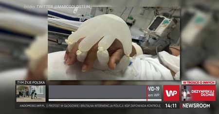 Prof. Rejdak o pacjentach umierających w samotności na COVID-19