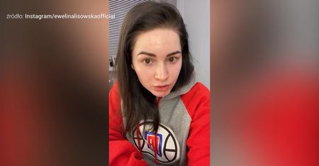 Ewelina Lisowska nawołuje do naturlanego wyglądu