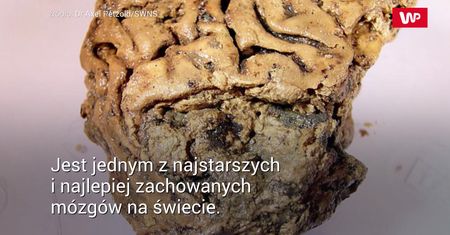 Mózg sprzed 2,6 tys. lat może pomóc w walce z demencją