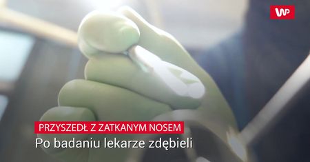 Przyszedł do lekarza z zatkanym nosem. Lekarze zrobili RTG i zdębieli
