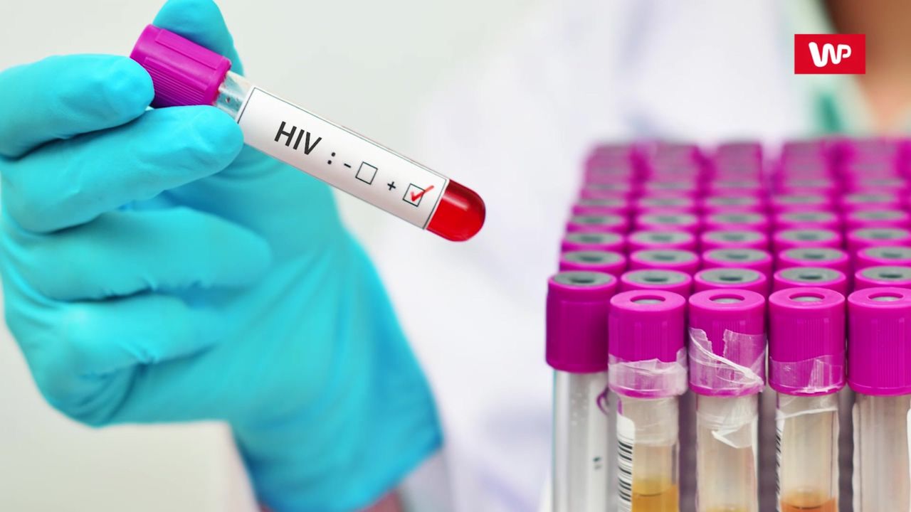 Objawy zakażenia wirusem HIV. Nie są charakterystyczne