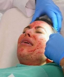 Kim Kardashian jak Krwawa Mary! Co oni robią z jej twarzą?!