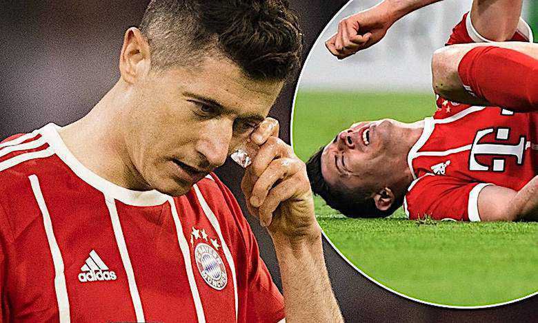 Robert Lewandowski pobity na meczu