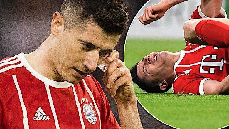 Robert Lewandowski pobity na meczu