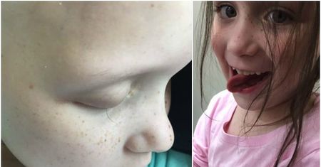 Ojciec sfotografował ostatnią rzęsę walczącej z rakiem 7-letniej córki