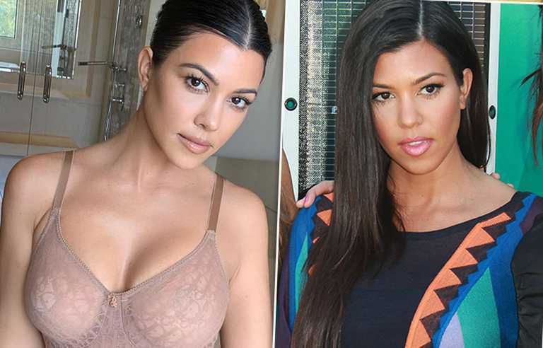 Kourtney Kardashian - po i przed operacją biustu