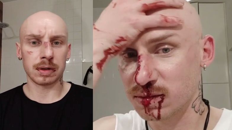 Jacek Szawioła z "Gogglebox" został pobity