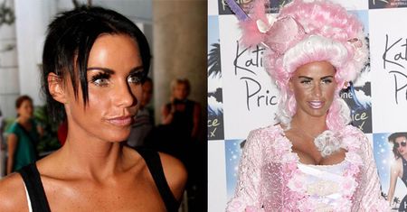 Katie Price: "Moja twarz jest NATURALNA"