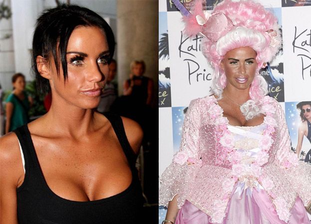 Katie Price: "Moja twarz jest NATURALNA"