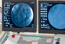 Angiografia - na czym polega, wskazania, przeciwwskazania, powikłania