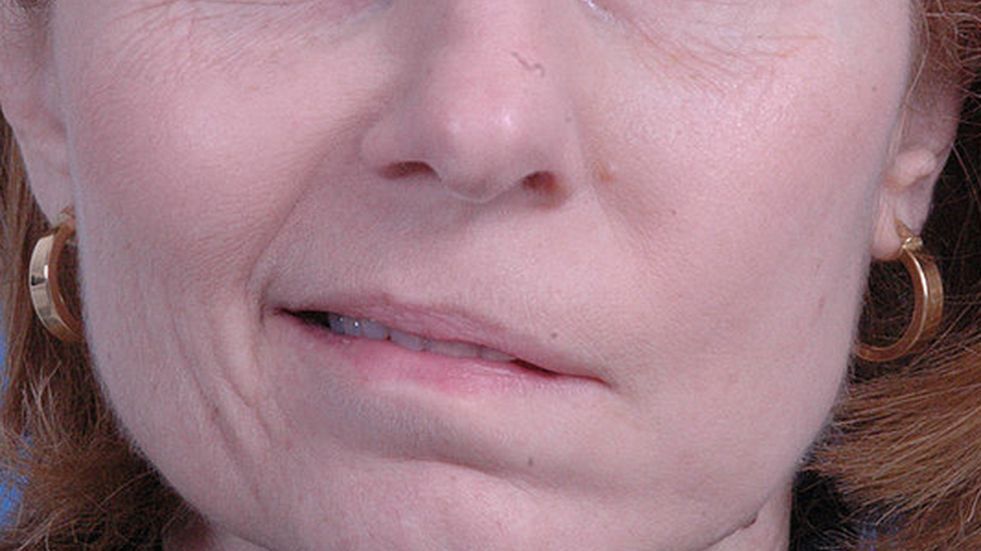 Wiele osób ma negatywny stosunek do szczepionki. Pomimo zagrożenia zakażeniem grupa ta nie będzie chciała się zaszczepić. Uważają, że szczepionka powstała w zbyt krótkim czasie i może przez to być niebezpieczna. Dotychczas żadne głosy nie mówiły o skutkach ubocznych aż do teraz. Te wystąpiły u 4 wolontariuszy testujących szczepionkę.