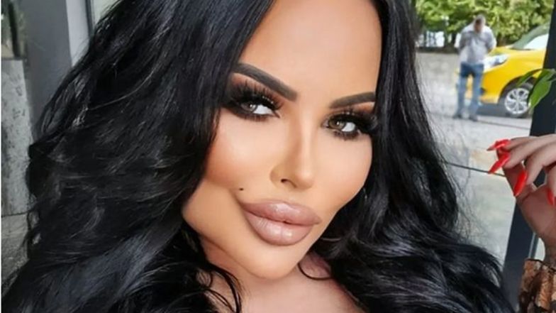 Esmeralda Godlewska chwali się efektami zabiegów w tureckiej klinice