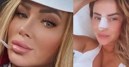 Iza z "Królowych Życia" zrobiła sobie kolejną OPERACJĘ NOSA: "Po poprzedniej końcówka poszła do dołu"