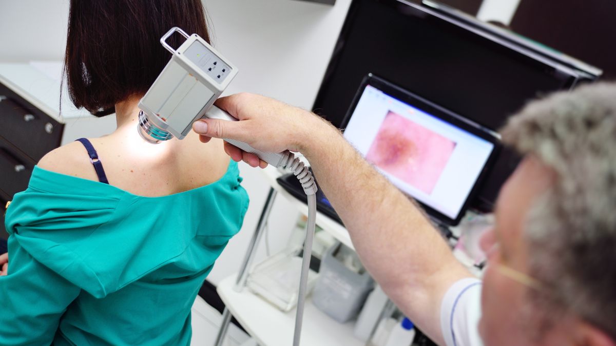 Wideodermatoskopia to nowoczesna metoda diagnostyczna