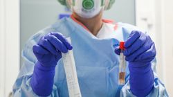 Jak odróżnić RSV od SARS-CoV-2? Eksperci wyjaśniają