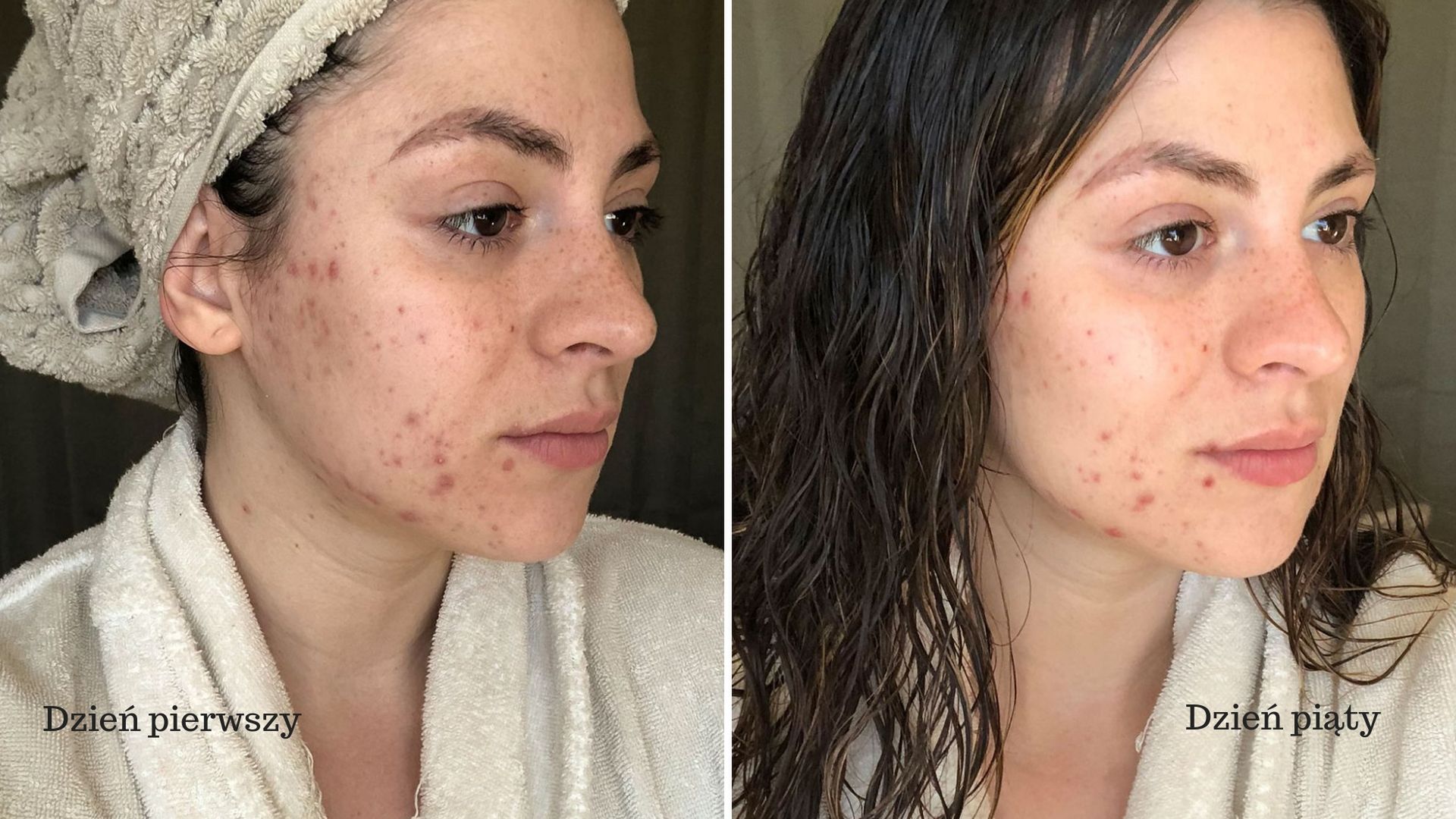 Jessica robiła sobie seflie w czasie trwania eksperymentu [prevention.com]