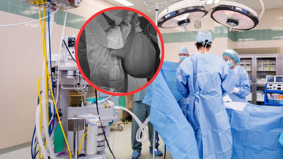 Lekarze z Iławy usunęli pacjentce monstrualnego guza / zdjęcie poglądowe