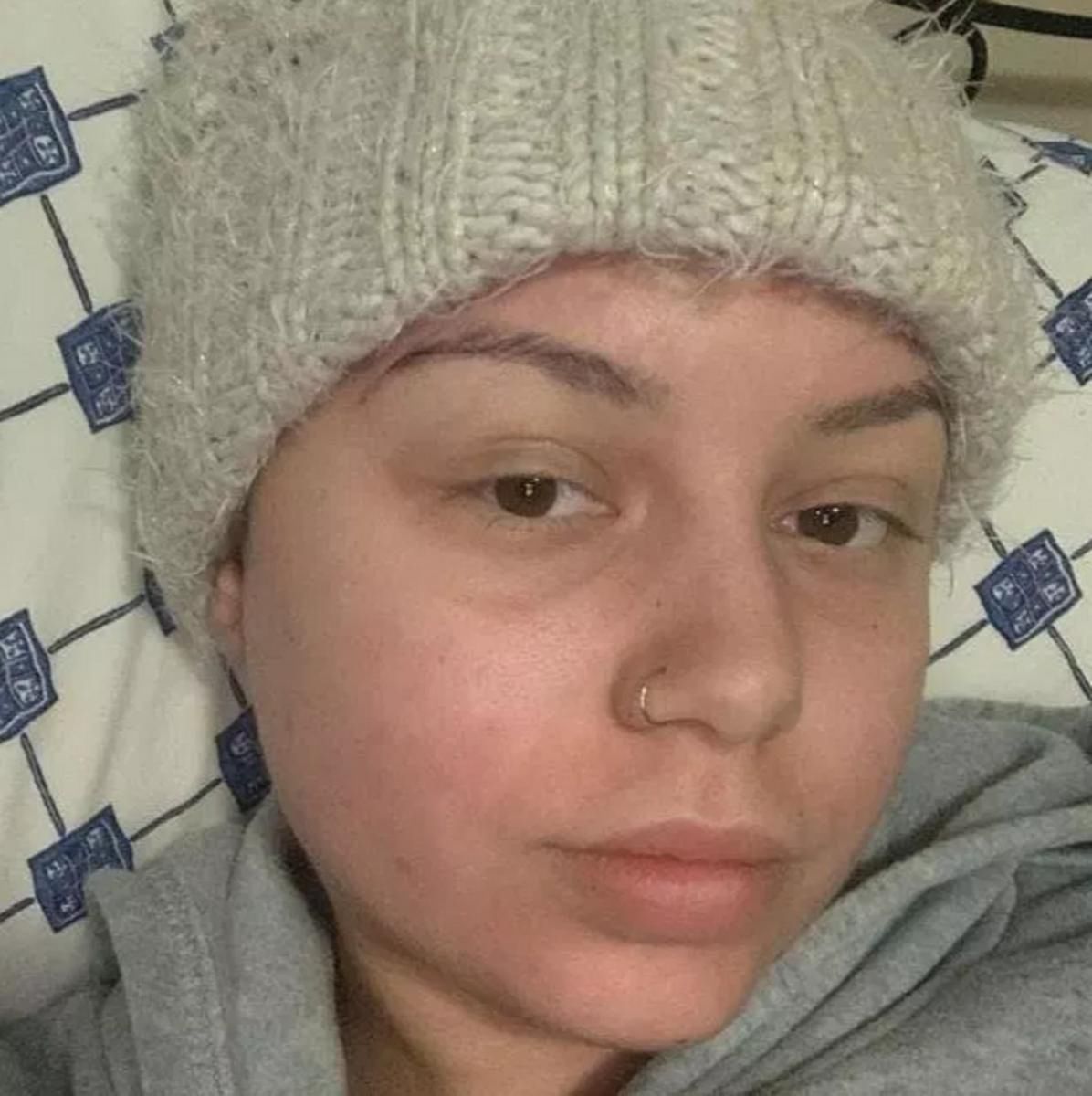 Olivia Nikolic w czasie chemioterapii. Chłoniak jest uleczalny