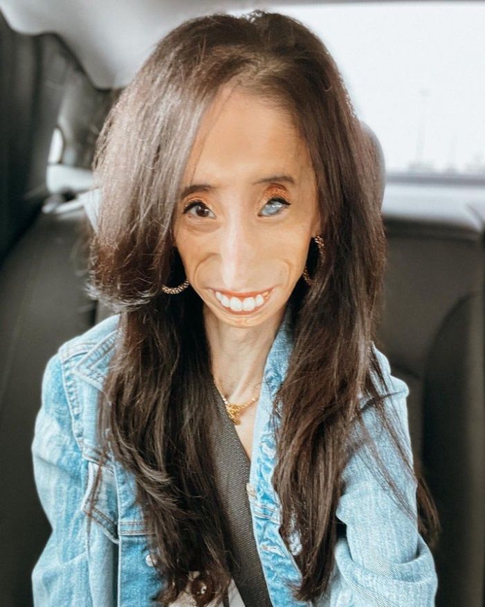 Lizzie Velasquez