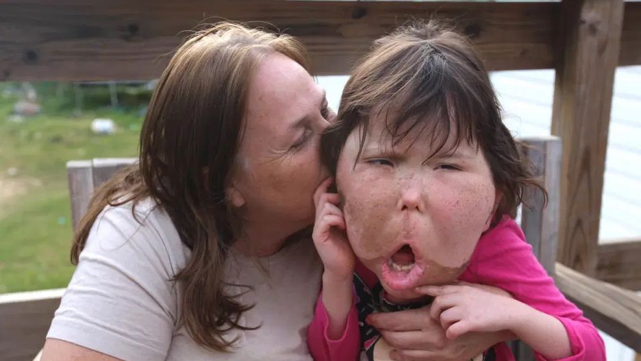 Cierpi na rzadką chorobę. Lekarze rozważają nazwanie zaburzenia jej imieniem