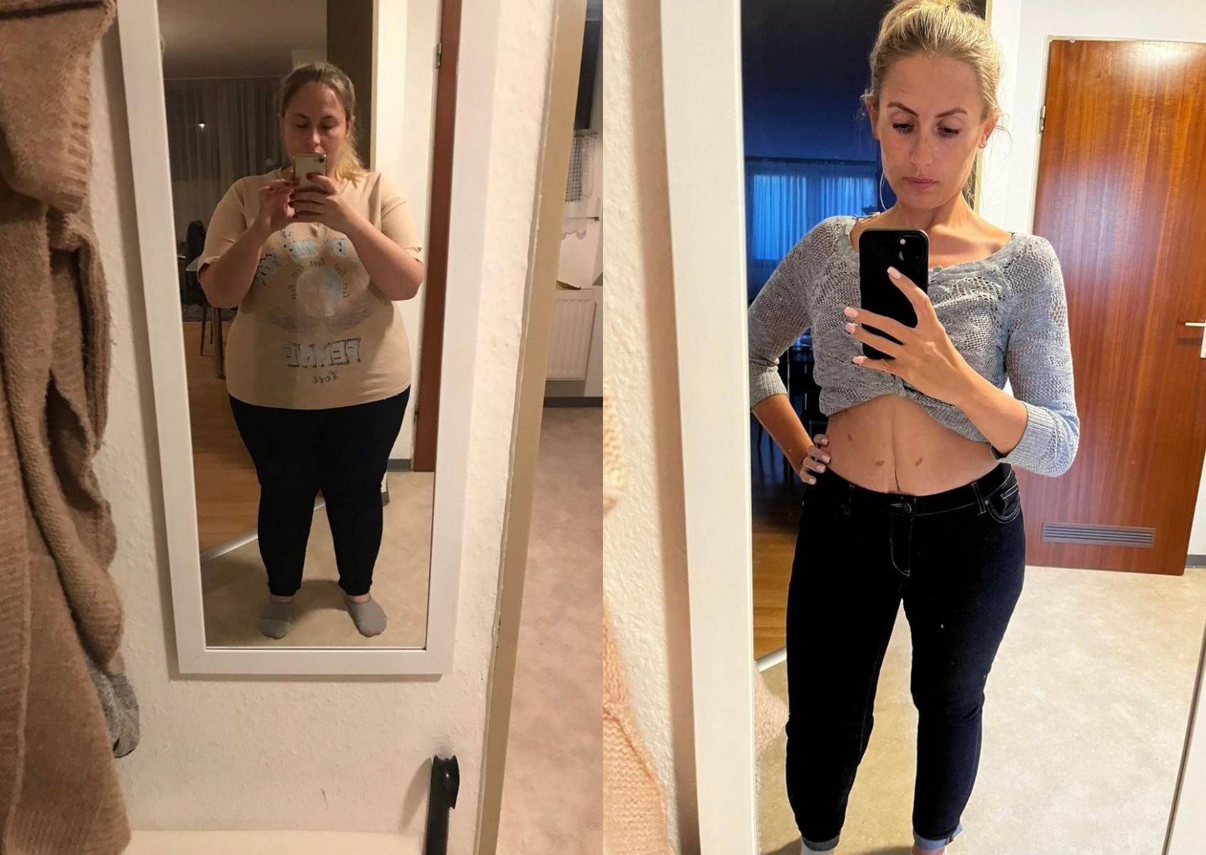 Agnieszka Parejko przed i po operacji