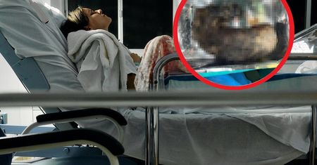 Chirurg aż złapał za telefon. Oto co wyciągnęli z brzucha 9-latki
