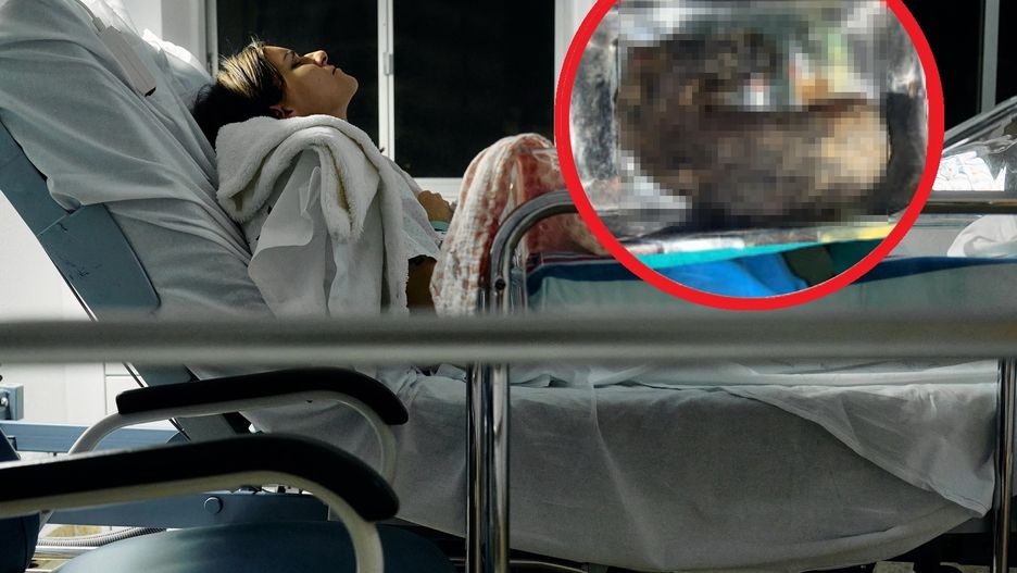 Znaleźli prawie kilogram włosów w żołądku dziewięciolatki. "Pierwszy taki przypadek"