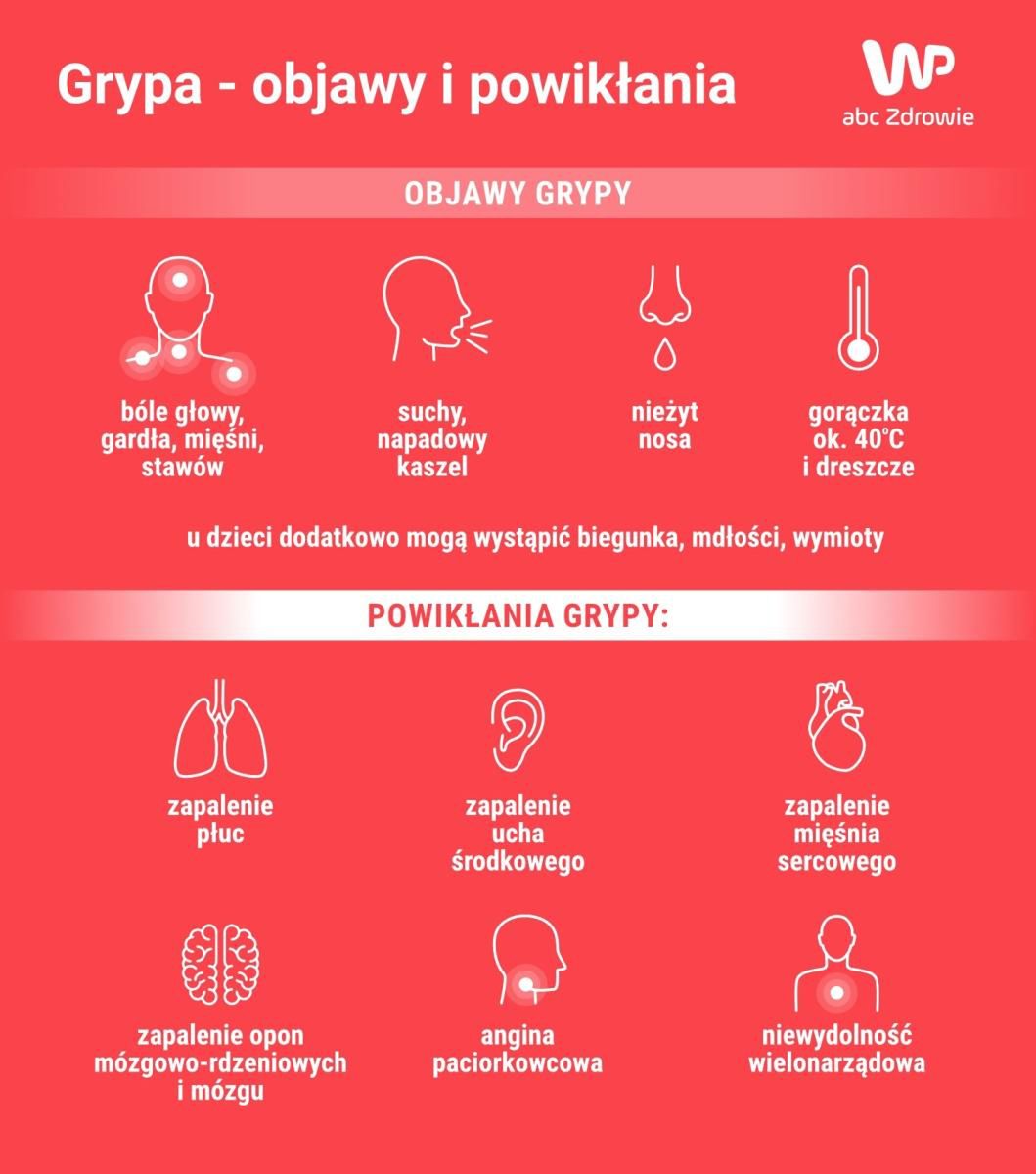 Jakie objawy daje grypa?
