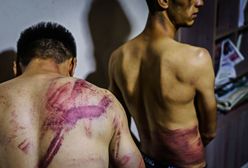 Horror w Afganistanie. Dziennikarze pokazali zdjęcia. Mówią o torturach