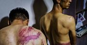Horror w Afganistanie. Dziennikarze pokazali zdjęcia. Mówią o torturach