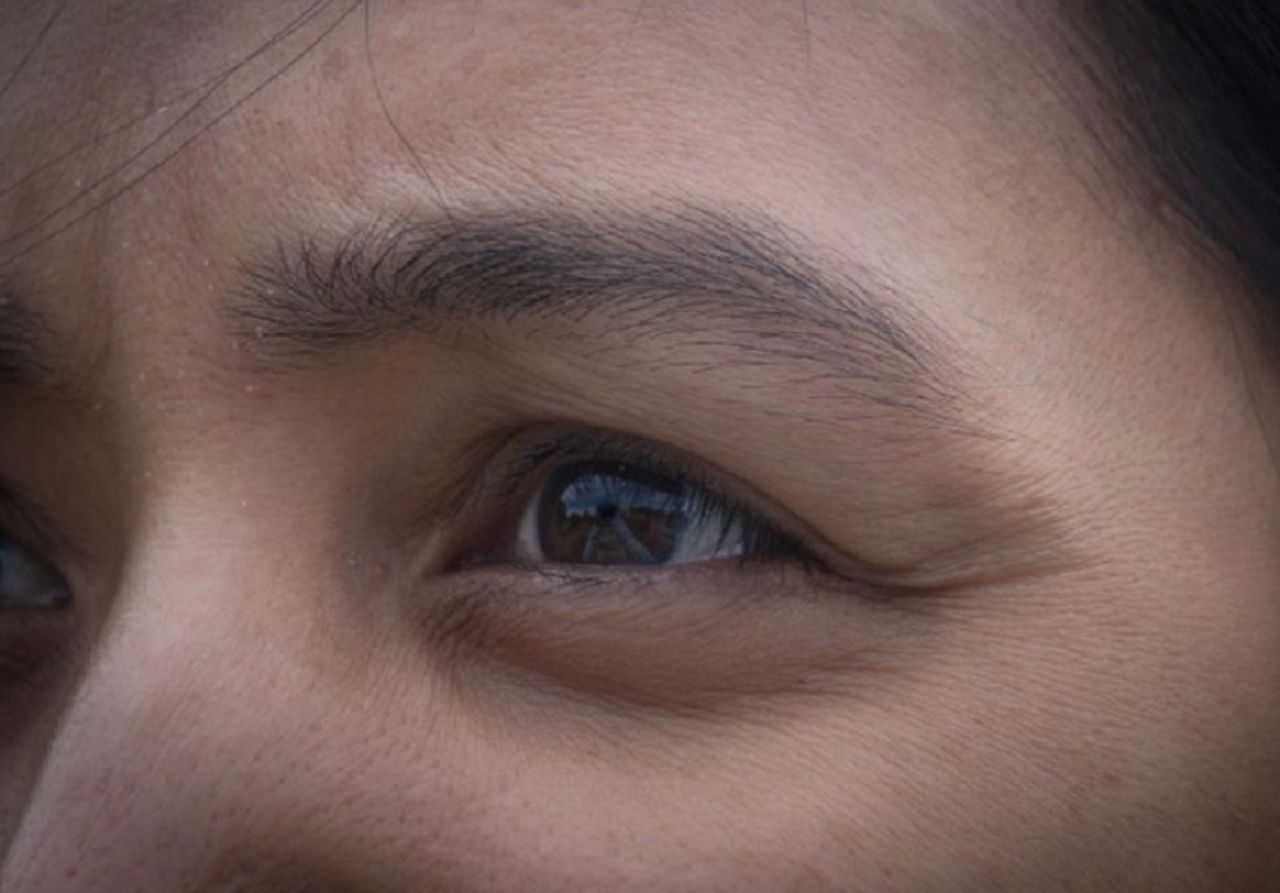 Cienie i worki pod oczami – skąd się biorą i jak je usunąć?