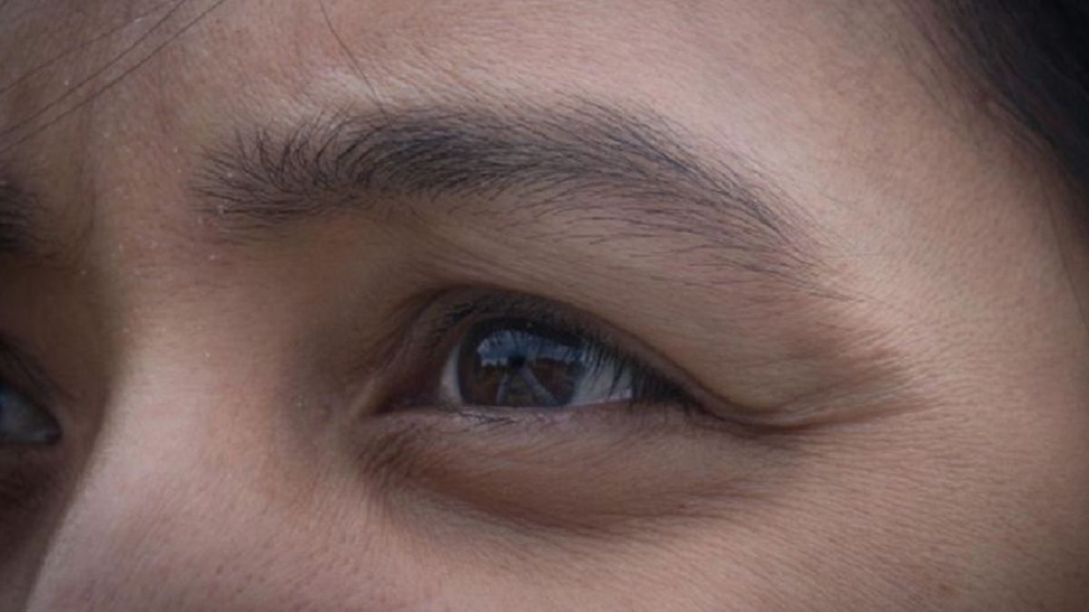 Cienie i worki pod oczami pojawiają się nie tylko u osób przemęczonych i nie stroniących od używek.