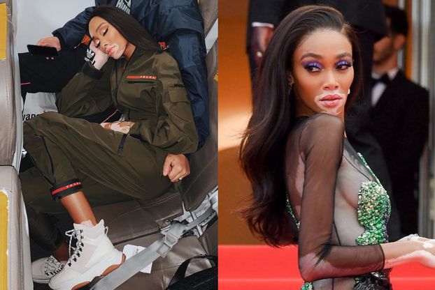 Dramat Winnie Harlow. Modelka z bielactwem musiała lecieć klasą ekonomiczną. "Jesteś TAKA ODWAŻNA"