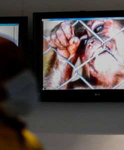 Nowe przypadki małpiej ospy w Polsce