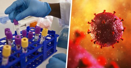 Piąta osoba wyleczona z HIV. To mężczyzna z Niemiec