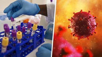 Piąta osoba wyleczona z HIV. To mężczyzna z Niemiec