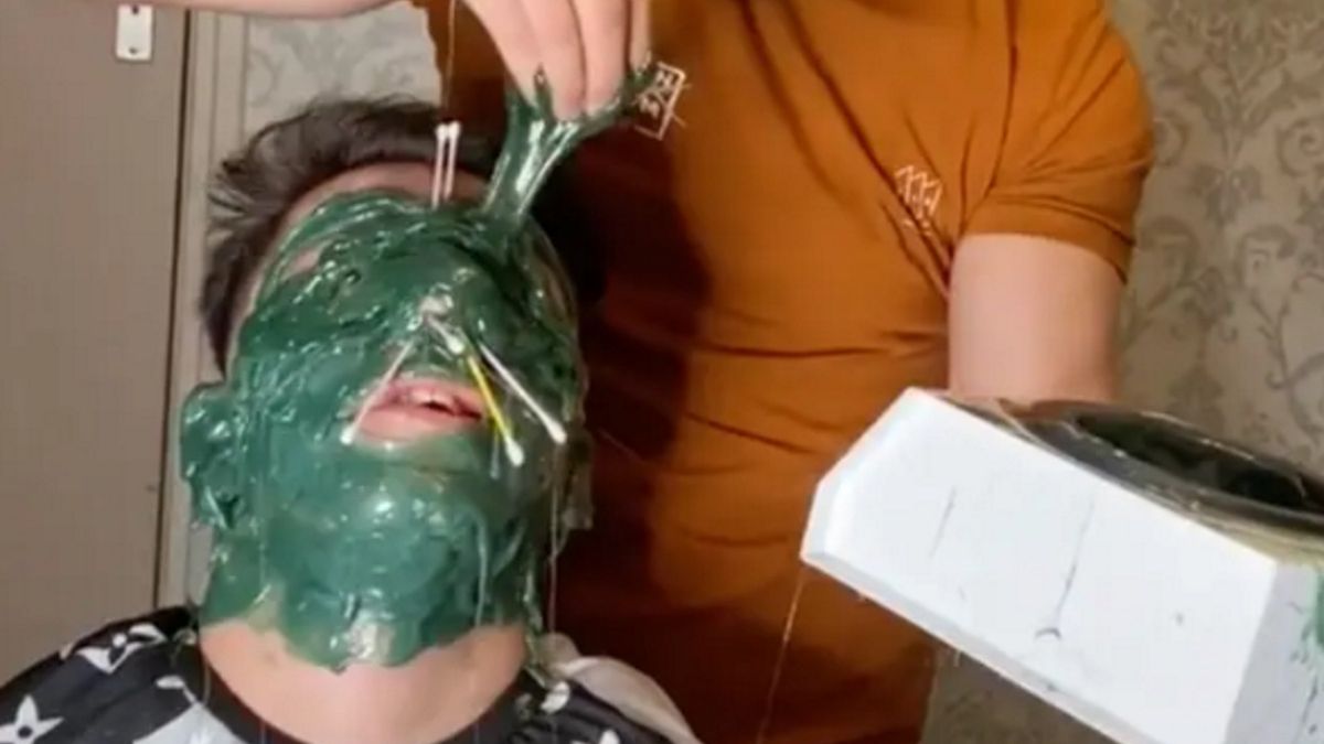 Zabieg może być niebezpiecnzy