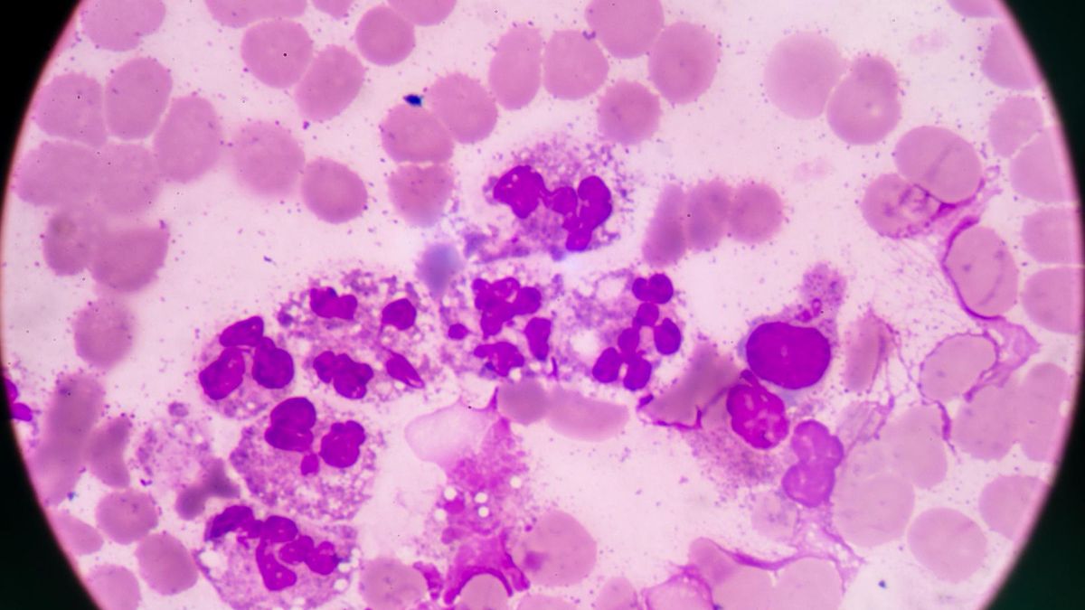 Neutrofile i ich znaczenie dla organizmu