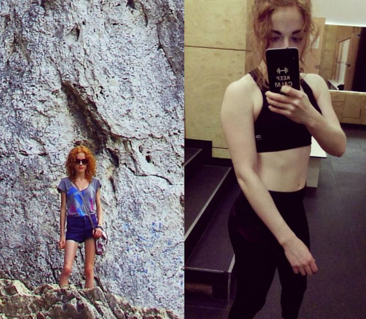 Karolina Dudek - w czasie i po walce z anoreksja