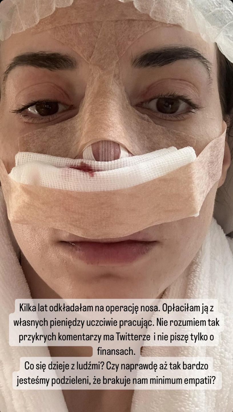 Marianna Schreiber przeszła operację nosa