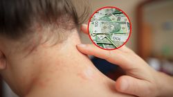 Milion Polaków choruje, większość nawet o tym nie wie. A mogą należeć się ulgi